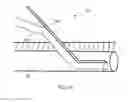 Fig. 19 - Anatomic needle system