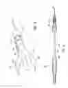Fig. 07 - Luminal stenting