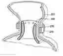 Fig. 01 - Endolumenal esophageal restriction device