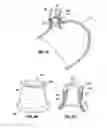 Fig. 06 - Endolumenal esophageal restriction device