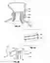 Fig. 08 - Endolumenal esophageal restriction device