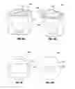 Fig. 10 - Endolumenal esophageal restriction device