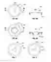 Fig. 12 - Endolumenal esophageal restriction device