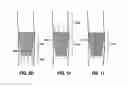 Fig. 14 - Endolumenal esophageal restriction device