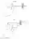 Fig. 16 - Method and instrument for treating obesity