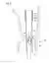 Fig. 05 - Digestive tract device