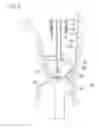 Fig. 08 - Digestive tract device