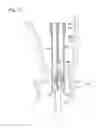 Fig. 10 - Digestive tract device
