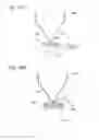 Fig. 14 - Digestive tract device