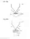 Fig. 15 - Digestive tract device