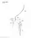 Fig. 16 - Digestive tract device