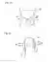 Fig. 17 - Digestive tract device