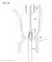 Fig. 20 - Digestive tract device