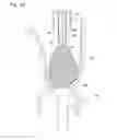 Fig. 24 - Digestive tract device