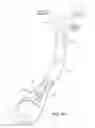 Fig. 10 - Positioning tools and methods for implanting medical devices