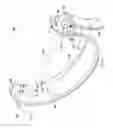 Fig. 05 - Device for applying pressure to bones of arm and method of treatment