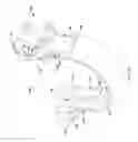 Fig. 11 - Device for applying pressure to bones of arm and method of treatment