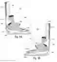 Fig. 02 - SEQUENTIAL SERIES OF ORTHOPEDIC DEVICES THAT INCLUDE INCREMENTAL CHANGES IN FORM