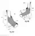 Fig. 08 - SEQUENTIAL SERIES OF ORTHOPEDIC DEVICES THAT INCLUDE INCREMENTAL CHANGES IN FORM