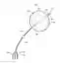 Fig. 01 - Balloon immobilization device for radiation treatment