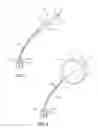 Fig. 02 - Balloon immobilization device for radiation treatment