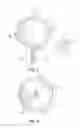 Fig. 03 - Balloon immobilization device for radiation treatment