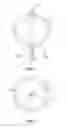 Fig. 04 - Balloon immobilization device for radiation treatment