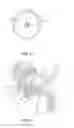 Fig. 08 - Balloon immobilization device for radiation treatment