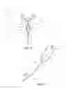 Fig. 10 - Balloon immobilization device for radiation treatment