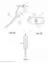 Fig. 11 - Balloon immobilization device for radiation treatment
