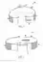 Fig. 02 - ARM IMMOBILIZATION DEVICE AND ASSOCIATED METHODS