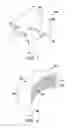 Fig. 04 - ARM IMMOBILIZATION DEVICE AND ASSOCIATED METHODS