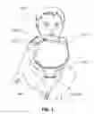 Fig. 02 - Arm immobilization apparatus