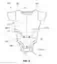 Fig. 03 - Arm immobilization apparatus