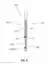 Fig. 04 - Arm immobilization apparatus