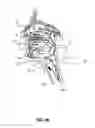 Fig. 04 - SYSTEMS AND METHODS FOR TREATMENT OF SLEEP APNEA