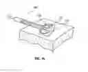 Fig. 12 - SYSTEMS AND METHODS FOR TREATMENT OF SLEEP APNEA