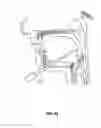 Fig. 30 - SYSTEMS AND METHODS FOR TREATMENT OF SLEEP APNEA