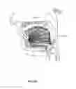 Fig. 34 - SYSTEMS AND METHODS FOR TREATMENT OF SLEEP APNEA