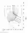 Fig. 02 - Tongue deformation implant