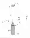 Fig. 13 - Tongue deformation implant