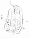 Fig. 03 - Method for producing a protrusion splint