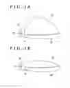 Fig. 02 - Intravaginal support device, fluid injection device, and treating method for pelvic organ prolapse by use of intravaginal support device