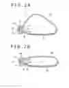 Fig. 03 - Intravaginal support device, fluid injection device, and treating method for pelvic organ prolapse by use of intravaginal support device