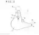 Fig. 04 - Intravaginal support device, fluid injection device, and treating method for pelvic organ prolapse by use of intravaginal support device