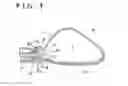 Fig. 05 - Intravaginal support device, fluid injection device, and treating method for pelvic organ prolapse by use of intravaginal support device