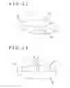 Fig. 11 - Intravaginal support device, fluid injection device, and treating method for pelvic organ prolapse by use of intravaginal support device