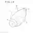 Fig. 12 - Intravaginal support device, fluid injection device, and treating method for pelvic organ prolapse by use of intravaginal support device