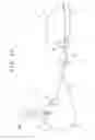 Fig. 13 - Intravaginal support device, fluid injection device, and treating method for pelvic organ prolapse by use of intravaginal support device
