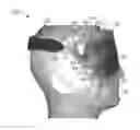 Fig. 01 - THERMAL EYE COMPRESS SYSTEMS AND METHODS OF USE